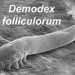 Demodex Mites and Their Connection to Chronic Dry Eye