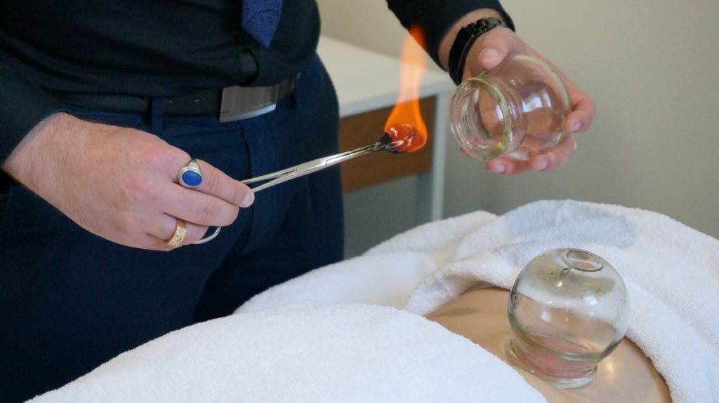 Cupping Therapy Benefits for Healing in Melbourne