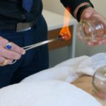 Cupping Therapy Benefits for Healing in Melbourne
